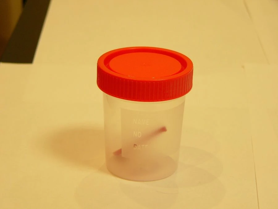 Disposable Sterile Polymer Container for Biological Samples 100ml with Spoon - KOP