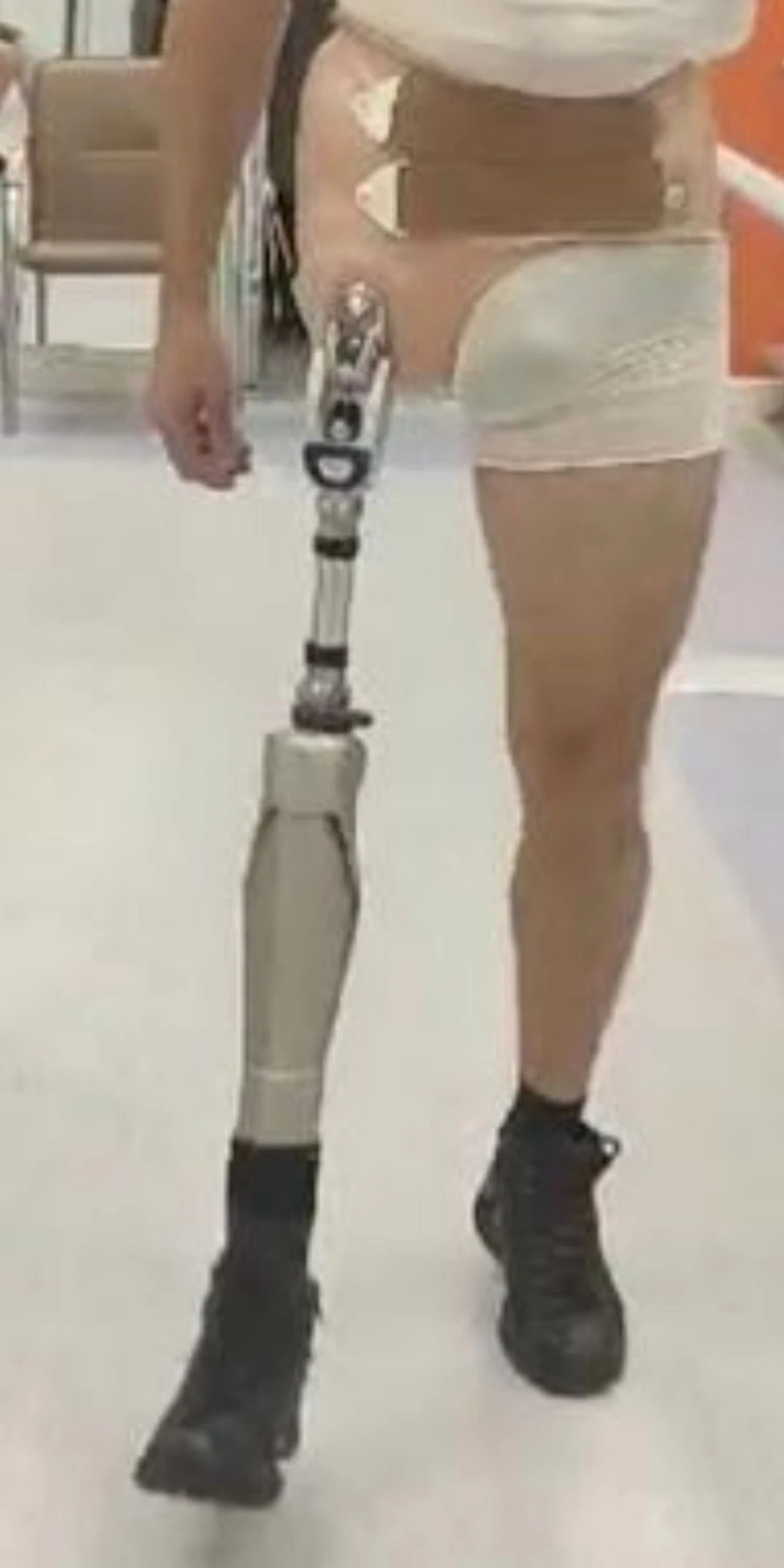 الأطراف الاصطناعية عند بتر الورك المودولية مع التحكم بالميكروبروسيسور